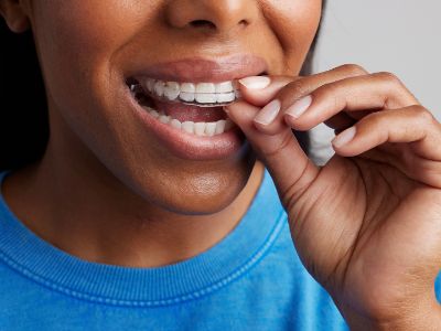 lady wearing appliance